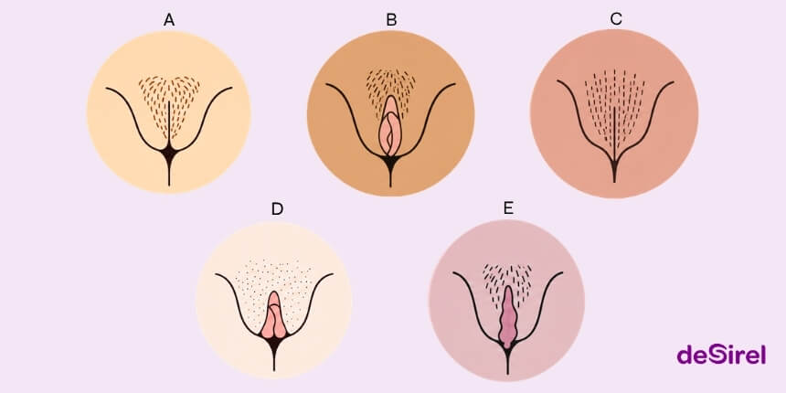 Soorten vagina vormen en de natuurlijke diversiteit van de vulva uitgelegd | Desirel.be Sexshop
